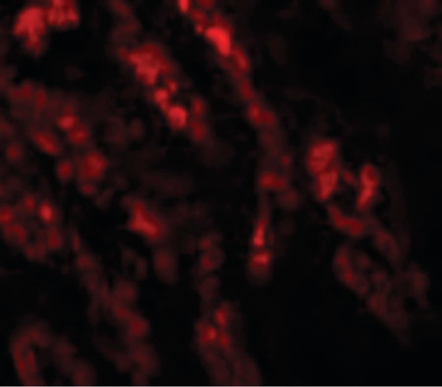 Polyclonal Rabbit anti-Human GLS2 / Glutaminase 2 Antibody (IHC, IF, WB)