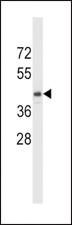 TDO2 Antibody (aa1-30)