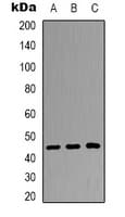 IHC-plus™ Polyclonal Rabbit anti-Human DUSP4 / MKP2 Antibody (Internal, IHC, WB)
