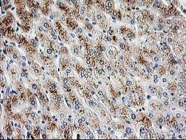 Monoclonal Mouse anti-Human PBX1 Antibody (clone OTI1C11, IHC, IF, WB)