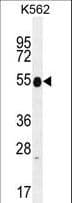 KRT25 / Keratin 25 Antibody (aa380-408)