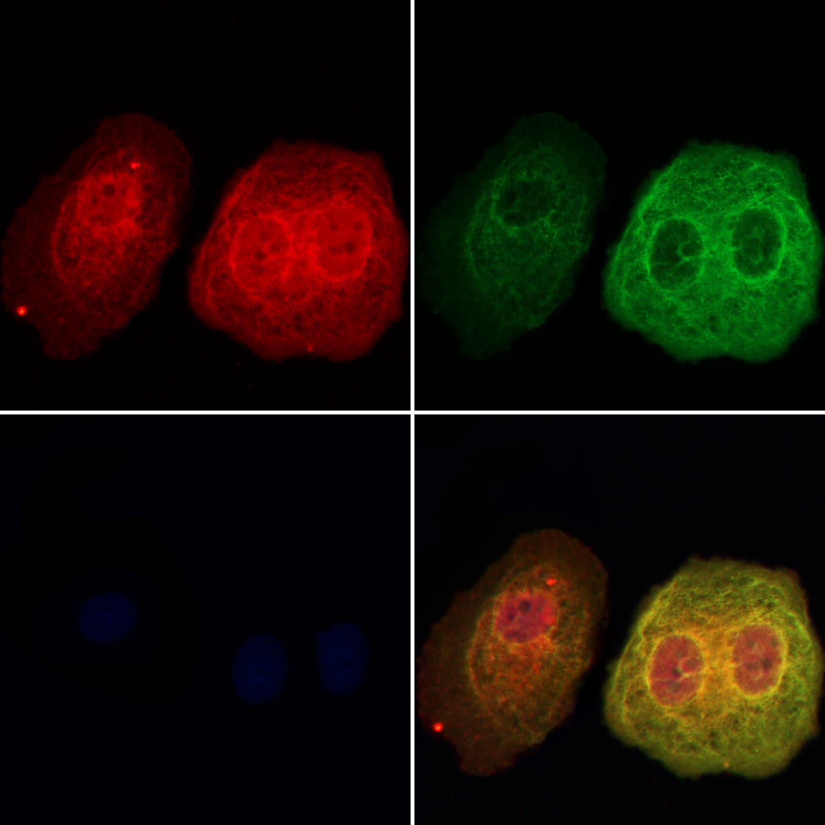 DNAJA2 Antibody