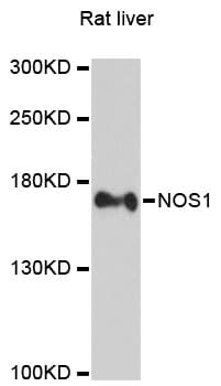 Polyclonal Rabbit anti-Human NOS1 / nNOS Antibody (IHC, WB)