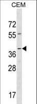 RAD52 Antibody (aa177-205)