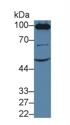 ACE2 / ACE-2 Antibody (aa334-409, PE)
