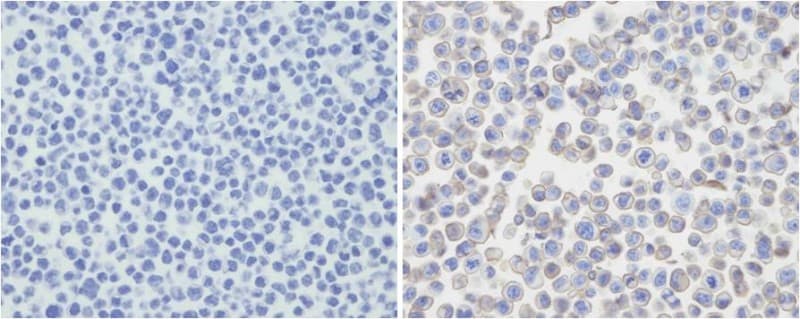 PD-L2 / PDCD1LG2 / CD273 Antibody (N-Terminus, clone 2011CT786.31.38)