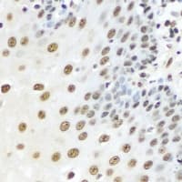 KPNA3 / Importin Alpha 4 Antibody