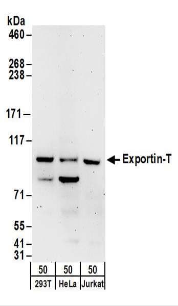 IHC-plus™ XPOT / Exportin-T Antibody (aa912-962)
