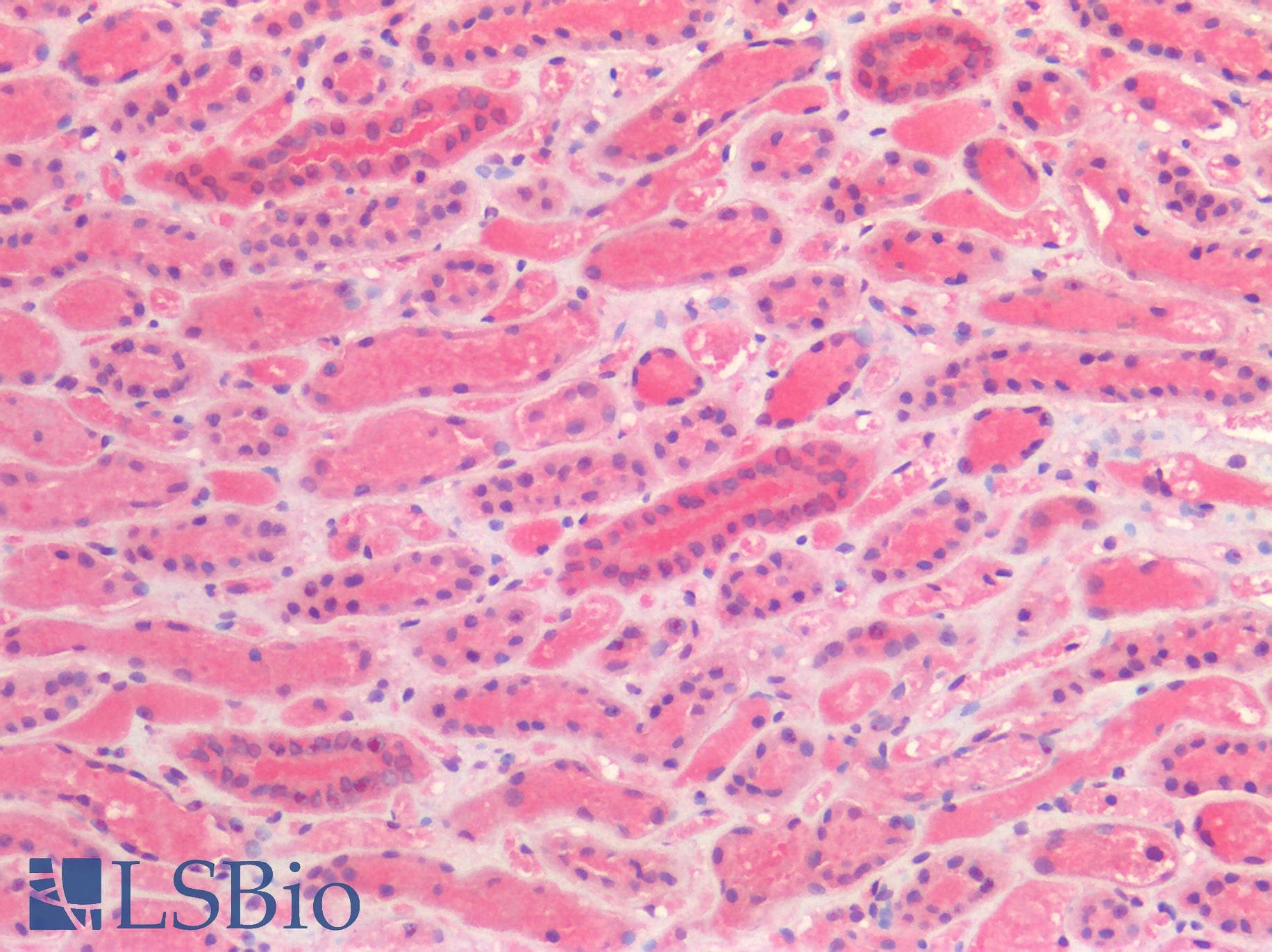 IHC-plus™ Kinesin Heavy Chain / KIF5B Antibody