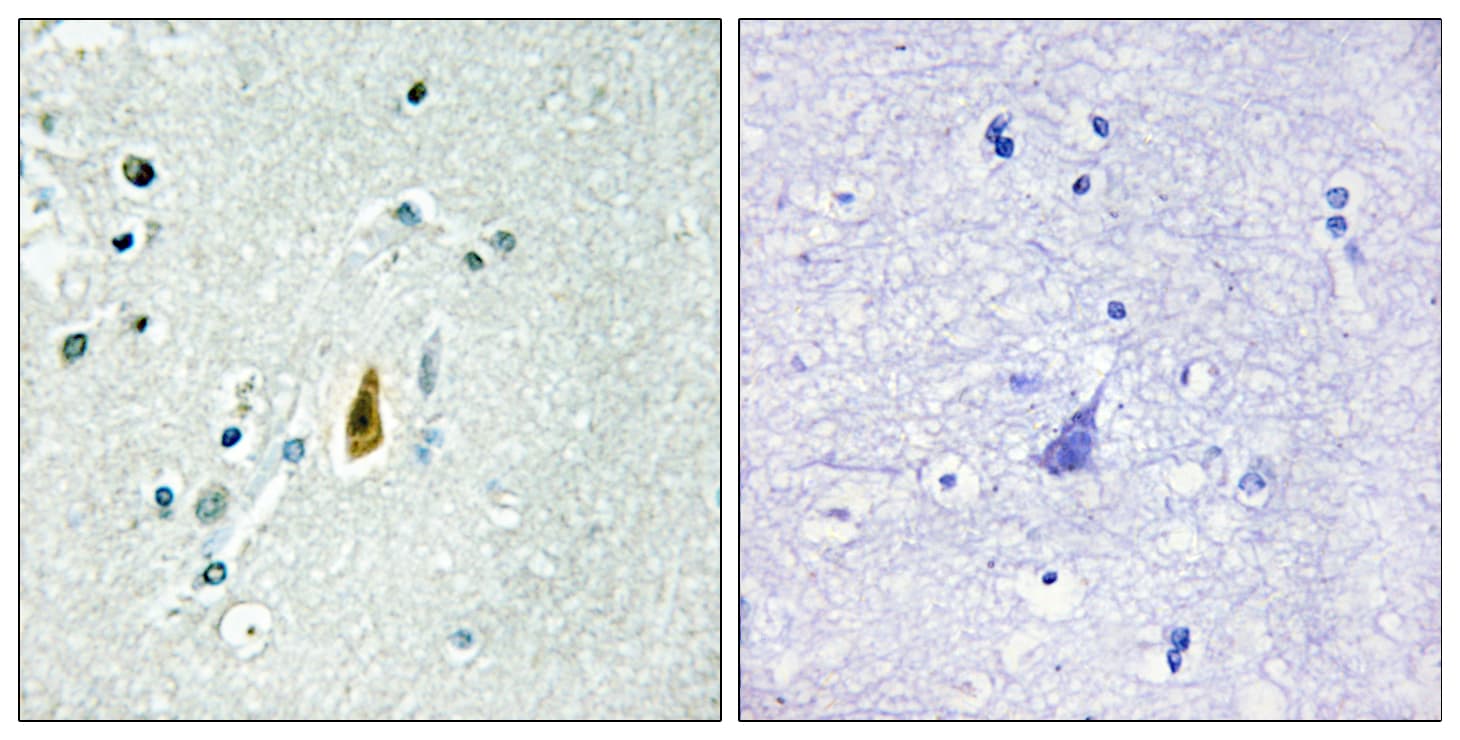 TP53 / p53 Antibody (phospho-Thr81)