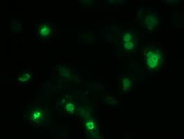 ZIM2 Antibody (clone OTI7G1)