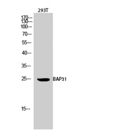 BCAP31 / BAP31 Antibody (120-200 aa, Internal)