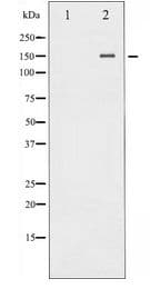 NOS3 / eNOS Antibody