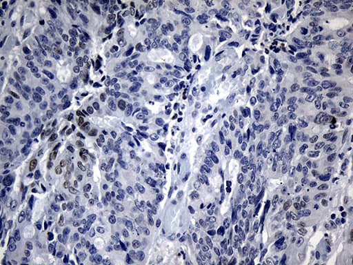 BHLHB2 / DEC1 Antibody (aa1-313, clone OTI10H1)