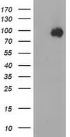 CTNNB1 / Beta Catenin Antibody (clone OTI6A3)