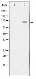 INSR / Insulin Receptor Antibody