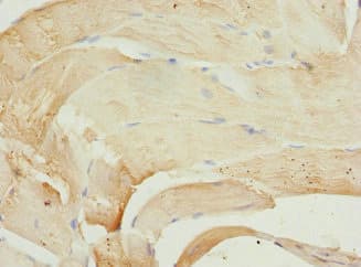 PIP5K1B Antibody