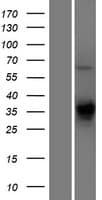 TMEM231 Protein (Over-Expression Lysate Myc-DDK (Flag))