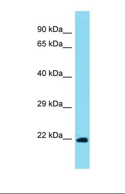 Polyclonal Rabbit anti-Mouse NDUFAF5 Antibody (C-Terminus, WB)