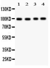 SYNPO / Synaptopodin Antibody (aa629-658)