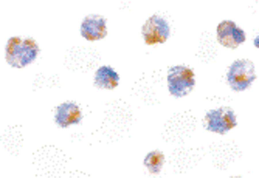 CFLAR / FLIP Antibody