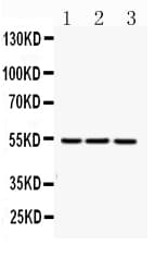Polyclonal Rabbit anti-Human FGG / Fibrinogen Gamma Antibody (IHC, WB)
