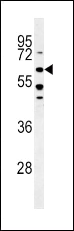 Polyclonal Rabbit anti-Human ALK3 / BMPR1A Antibody (aa166-195, IHC, WB)