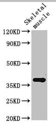 CTGF Antibody