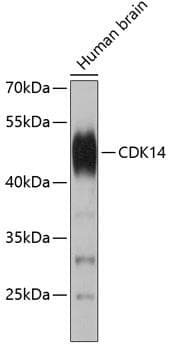 Polyclonal Rabbit anti-Human PFTK1 / CDK14 Antibody (WB)