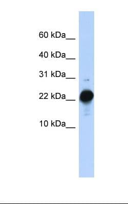 CSHL1 / CSH-Like 1 Antibody (C-Terminus)