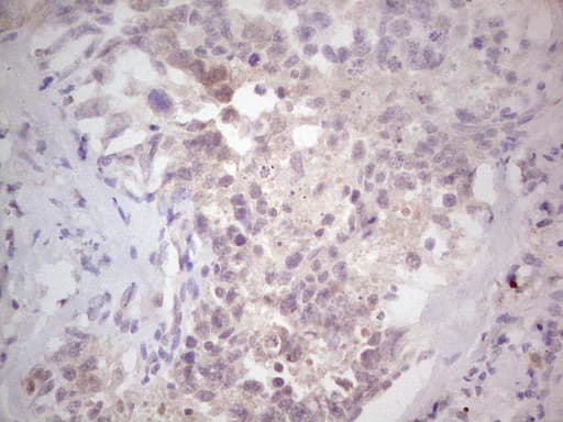 Monoclonal Mouse anti-Human NEFM / NF-M Antibody (clone OTI2G3, aa413-773, IHC, WB)