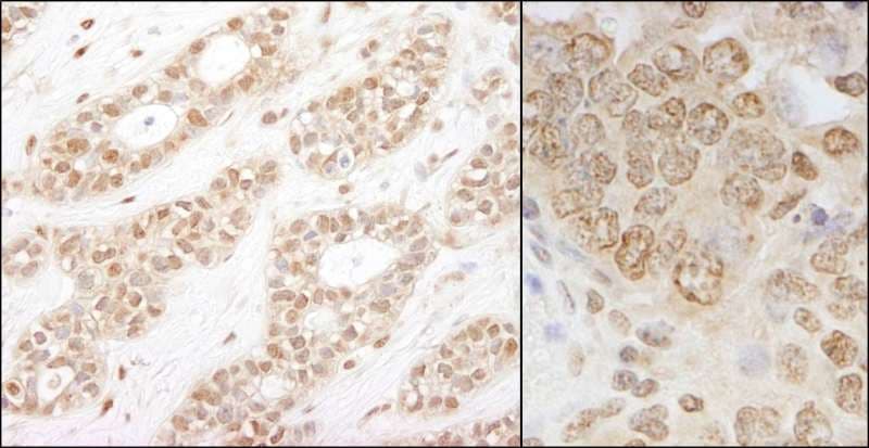 CHUK / IKKA / IKK Alpha Antibody (aa350-400)