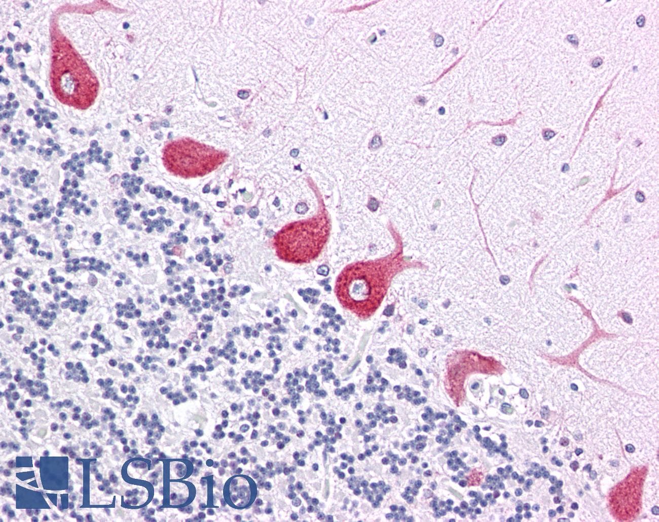 IHC-plus™ Polyclonal Rabbit anti-Human NEDL2 / HECW2 Antibody (Internal, IHC, IF, WB)
