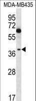 NFKBIL1 Antibody (aa327-356)