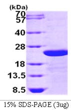 Human TGFBI Protein (Recombinant)