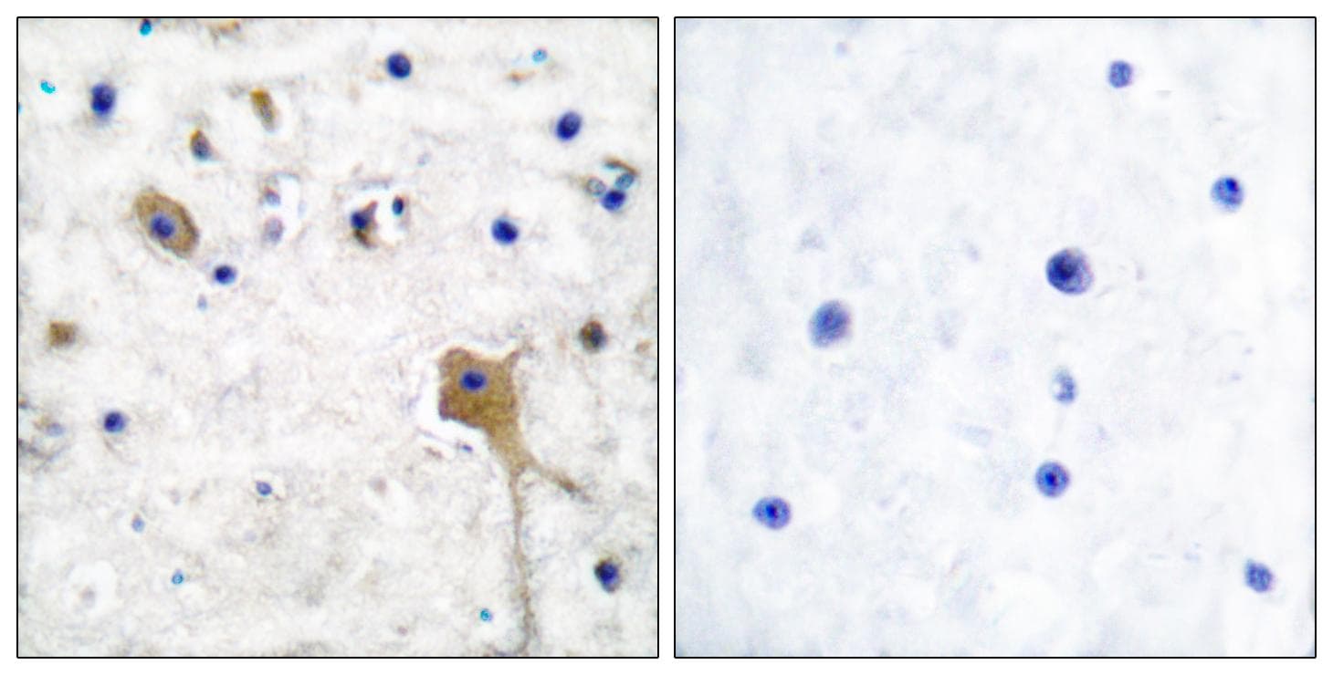 PTPN11 / SHP-2 / NS1 Antibody