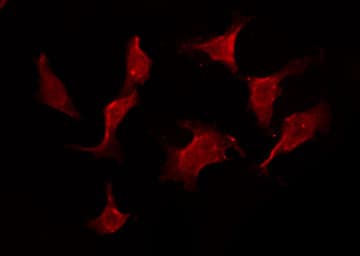 IL11RA Antibody (aa337-364)