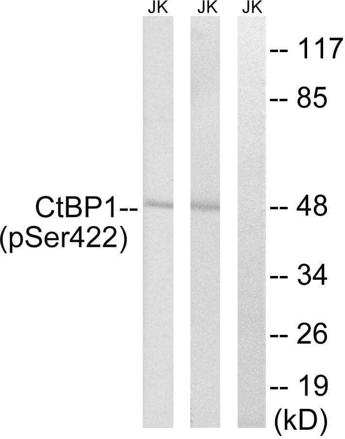 CTBP1 / CTBP Antibody (phospho-Ser422)
