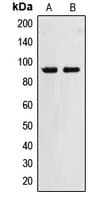 Polyclonal Rabbit anti-Human ZNF227 Antibody (Internal, WB)