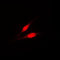 Polyclonal Rabbit anti-Human IKBKG / NEMO / IKK Gamma Antibody (Internal, IHC, IF, WB)