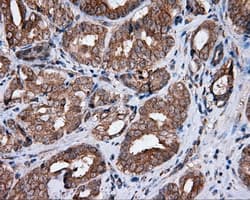 Monoclonal Mouse anti-Human HMRF1L / MTRF1L Antibody (clone OTI1H5, IHC, IF, WB)