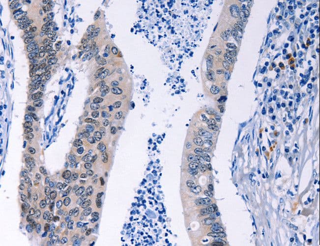 Polyclonal Rabbit anti-Human HMGB3 Antibody (IHC, WB)