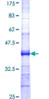 Human B3GALT5 Protein (Recombinant GST, N-terminus)