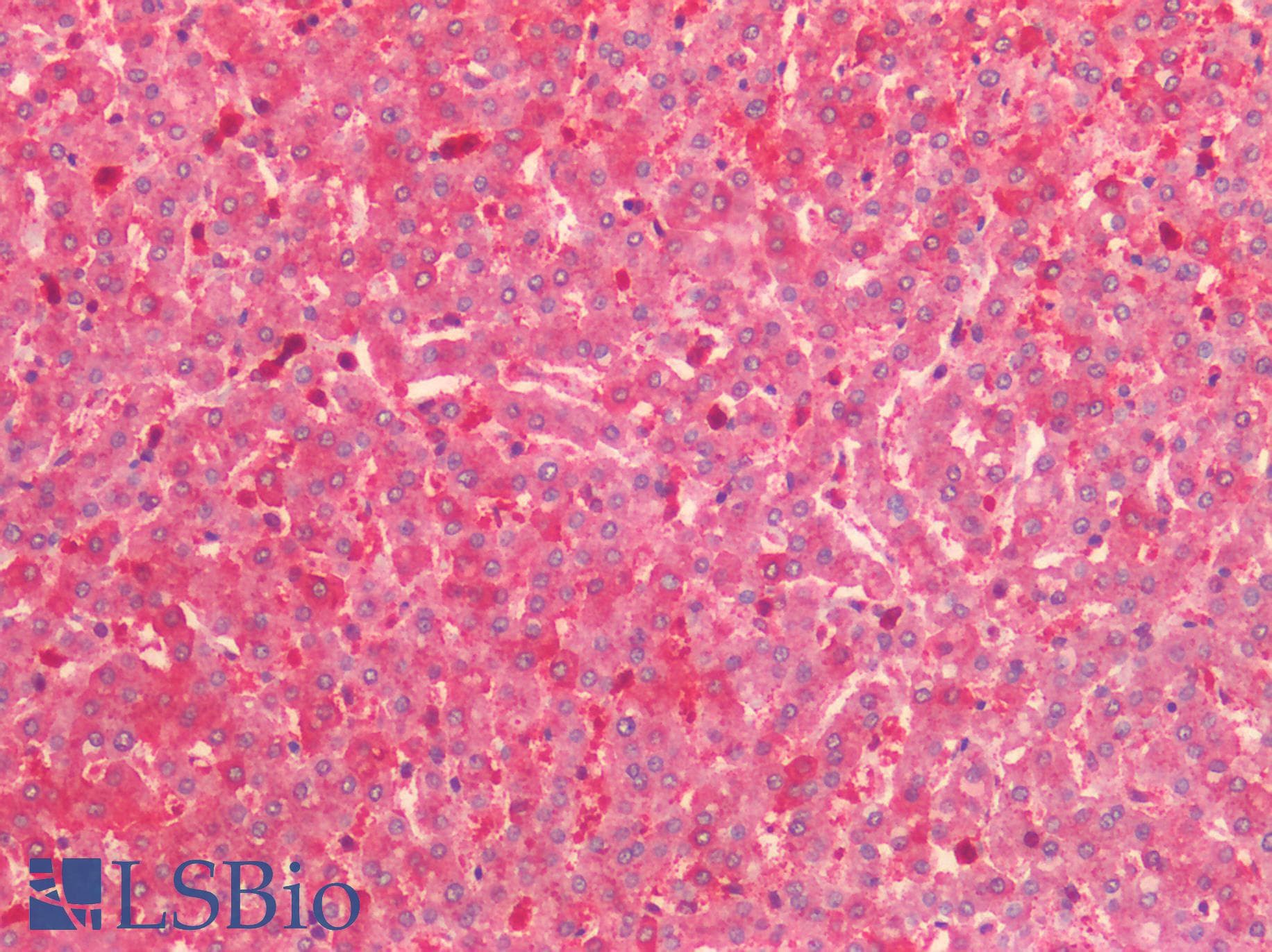 IHC-plus™ Polyclonal Rabbit anti-Human HTR2C / 5-HT2C Receptor Antibody (C-Terminus, IHC)