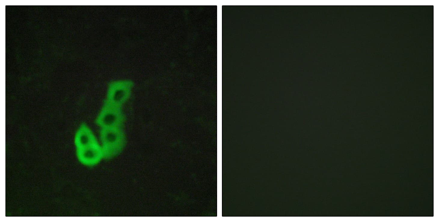 DRD1 / Dopamine Receptor D1 Antibody (aa135-184)