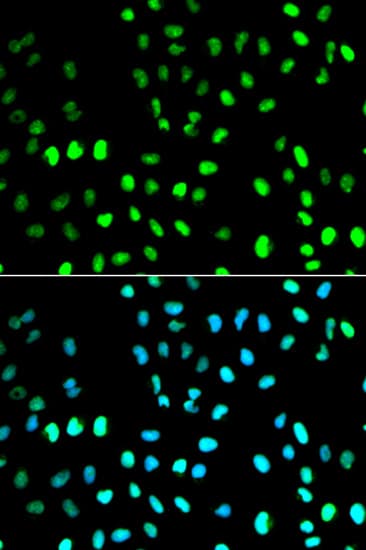 SUMO1 / SMT3 Antibody