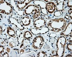 TLDC1 / KIAA1609 Antibody (clone OTI13H6)