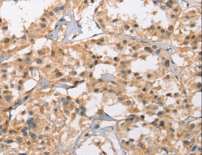 CACNA1D / Cav1.3 Antibody