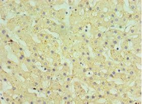 HSD11B1 / HSD11B Antibody (aa25-292)