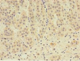 EPHX2 / Epoxide Hydrolase 2 Antibody (aa1-555)